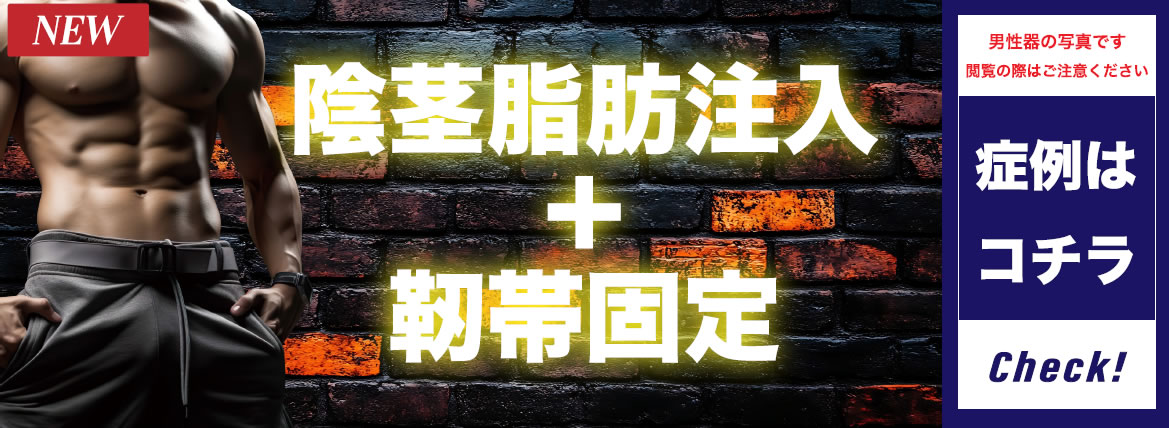 陰茎脂肪注入+靭帯固定