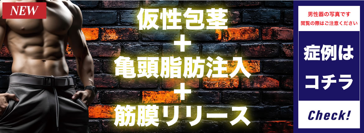 仮性包茎+亀頭脂肪注入+筋膜リリース